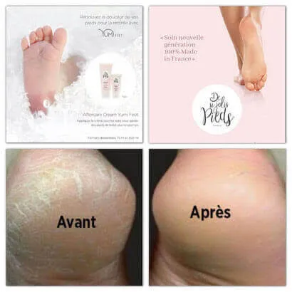 CONSEILS SOINS YUMI FEET